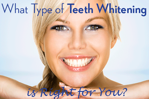 A smiling woman who has undergone teeth whitening