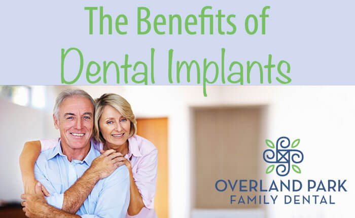 dental implants overland park