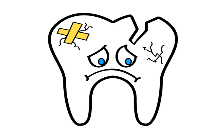 broken tooth cartoon needs a dental crown or bridge 