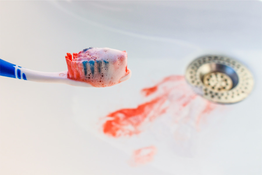 bloody toothbrush from bleeding gums