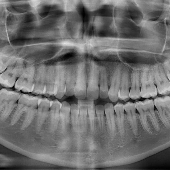 dental x-ray