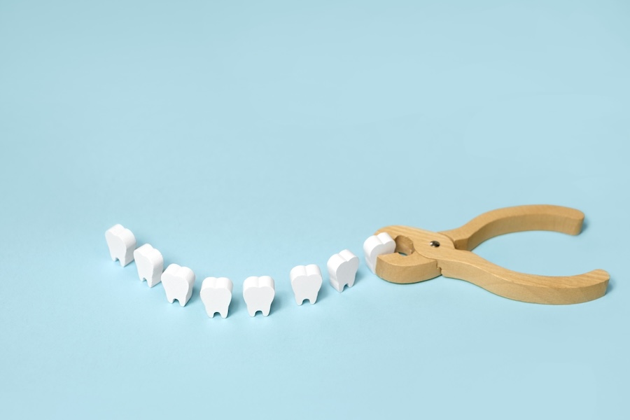wisdom tooth removal, image of wooden teeth with pliers for oral surgery